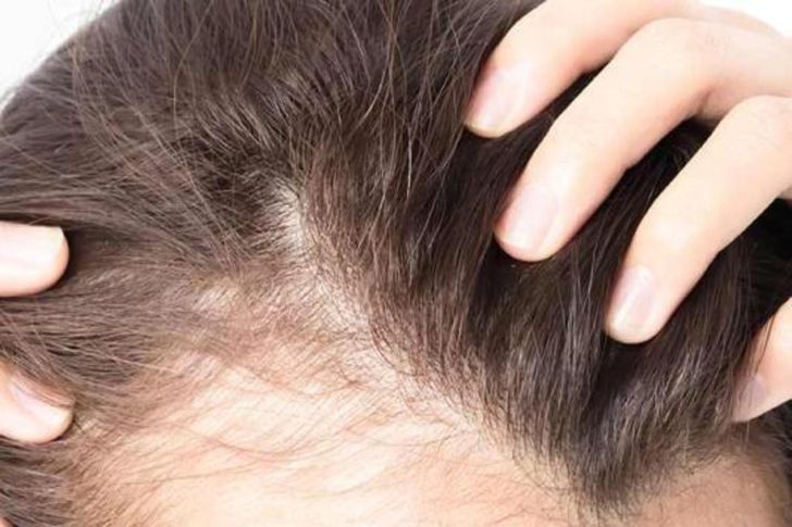 وصفات طبيعية لإنبات فراغات الشعر